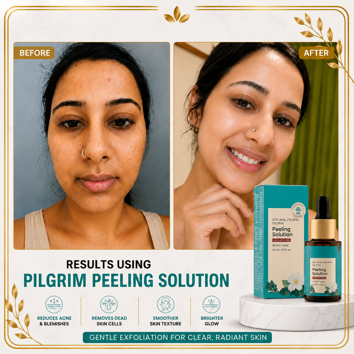 25% AHA, 2% BHA, 5% PHA Peeling Solution