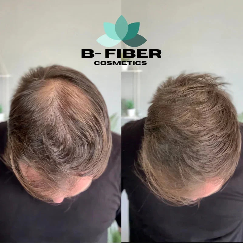 B-Fiber Hair Fiber | For Men & Women - Hair Growth Fiber Concealer