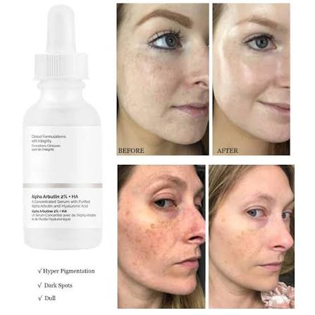 The Ordinary Alpha Arbutin 2% + HA - 30ml